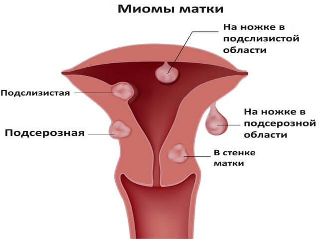 Почему болит матка